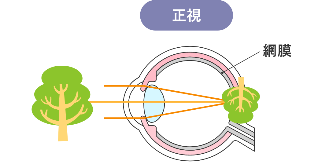 正視
