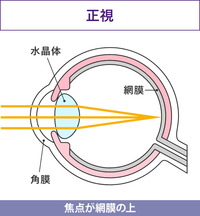 正視