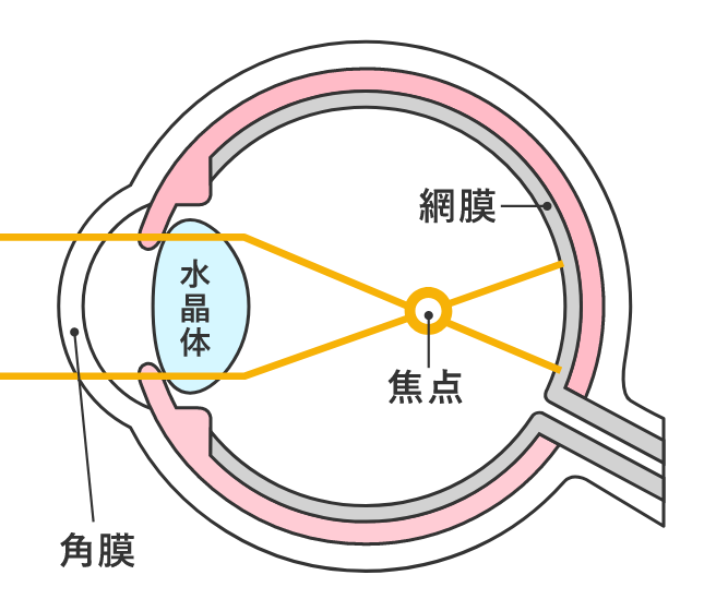 オルソケラトロジーとは